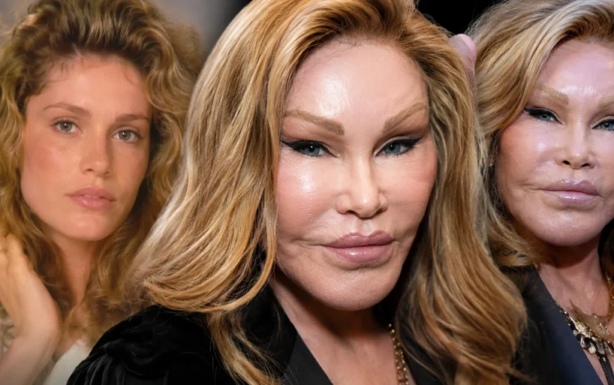 Cat Woman Plastic Surgery Story: What Happened to Jocelyn Wildenstein?