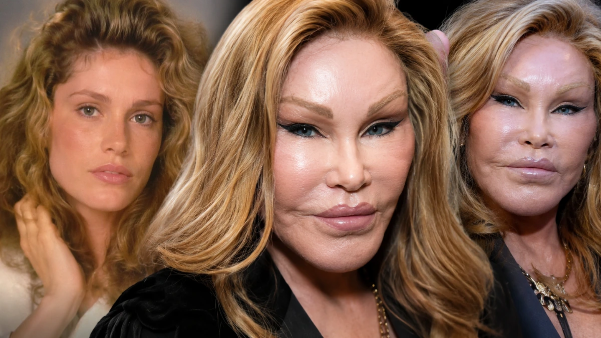 Cat Woman Plastic Surgery Story: What Happened to Jocelyn Wildenstein?